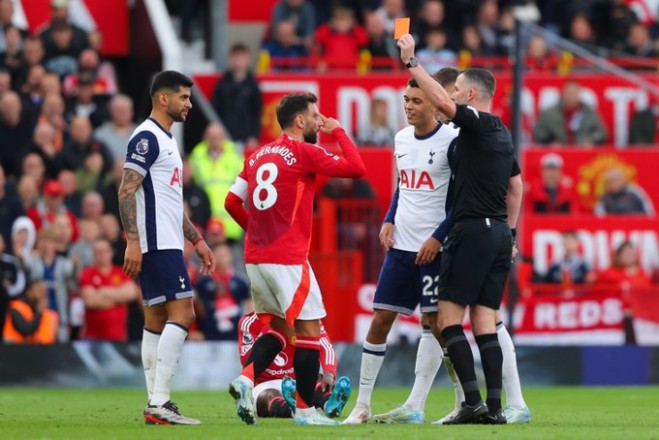 Fernandez: I let my team down, and I didn't deserve to be sent off